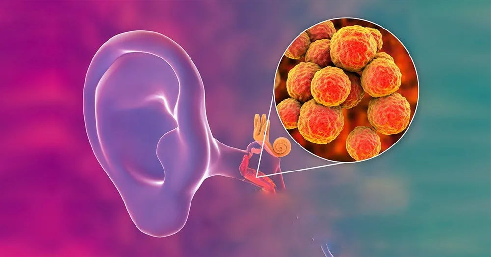 Hiểu rõ và phòng ngừa bệnh viêm tai giữa - Hình 2 - Bệnh viện SANTE Bình Thạnh, TP.HCM Hiểu rõ và phòng ngừa bệnh viêm tai giữa - Hình 2 - Bệnh viện SANTE Bình Thạnh, TP.HCM