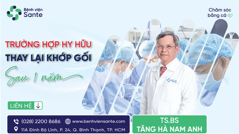 Hy hữu Thay lại khớp gối sau 1 năm - Bệnh viện SANTE Bình Thạnh, TP.HCM Hy hữu Thay lại khớp gối sau 1 năm - Bệnh viện SANTE Bình Thạnh, TP.HCM