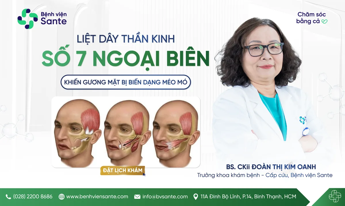 LIỆT DÂY THẦN KINH SỐ 7 NGOẠI BIÊN, MỘT CĂN BỆNH KHIẾN GƯƠNG MẶT BỊ BIẾN DẠNG - Bệnh viện SANTE Bình Thạnh, TP.HCM LIỆT DÂY THẦN KINH SỐ 7 NGOẠI BIÊN, MỘT CĂN BỆNH KHIẾN GƯƠNG MẶT BỊ BIẾN DẠNG - Bệnh viện SANTE Bình Thạnh, TP.HCM