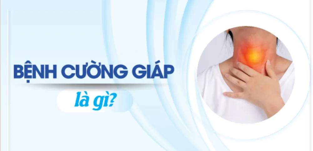 Bệnh viện Sante - Cường giáp là bệnh gì? Nguyên nhân_ dấu hiệu và cách chữa trị (Hình 3) Bệnh viện Sante - Cường giáp là bệnh gì? Nguyên nhân_ dấu hiệu và cách chữa trị (Hình 3)