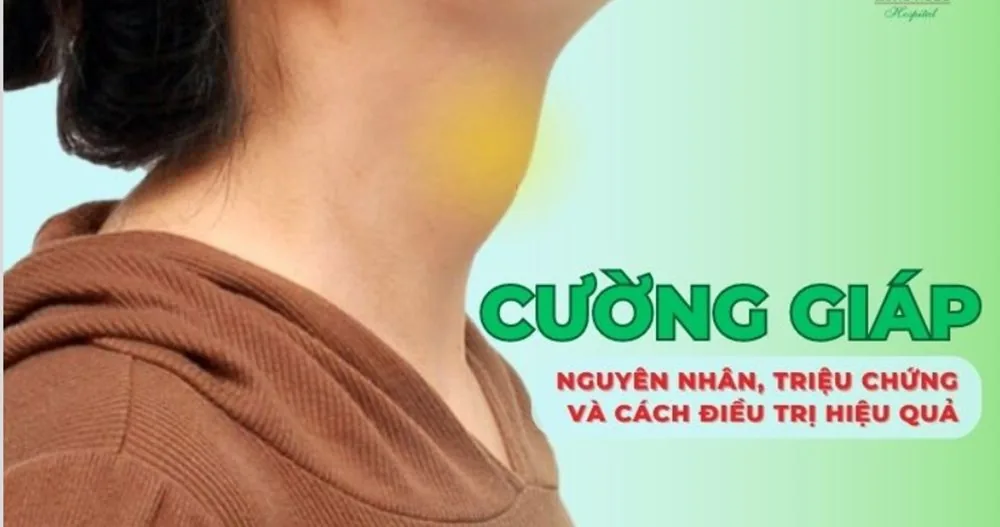 Bệnh viện Sante - Cường giáp là bệnh gì? Nguyên nhân_ dấu hiệu và cách chữa trị (Hình 4) Bệnh viện Sante - Cường giáp là bệnh gì? Nguyên nhân_ dấu hiệu và cách chữa trị (Hình 4)