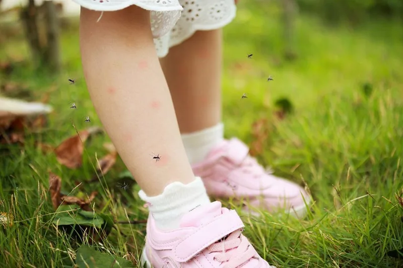 Bệnh viện Sante - Bệnh sốt xuất huyết Bệnh viện Sante - Bệnh sốt xuất huyết