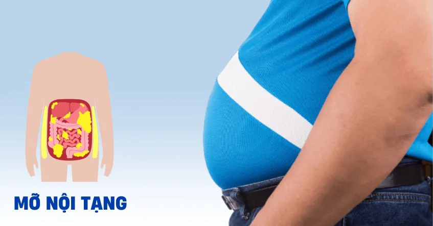 NGUYÊN NHÂN GÂY MỠ NỘI TẠNG - Hình 2 - Bệnh viện SANTE Bình Thạnh, TP.HCM NGUYÊN NHÂN GÂY MỠ NỘI TẠNG - Hình 2 - Bệnh viện SANTE Bình Thạnh, TP.HCM