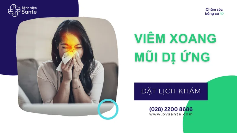 Viêm xoang mũi dị ứng - Bệnh viện SANTE Bình Thạnh, TP.HCM Viêm xoang mũi dị ứng - Bệnh viện SANTE Bình Thạnh, TP.HCM