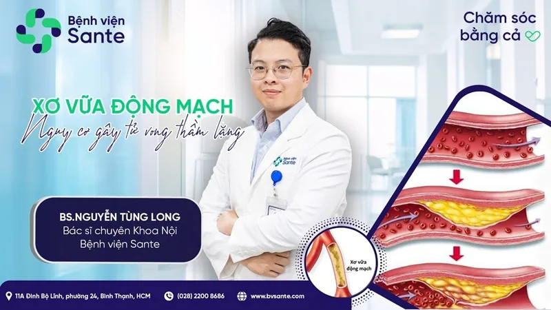 Xơ vữa động mạch - nguy cơ gây tử vong thầm lặng - Bệnh viện SANTE Bình Thạnh, TP.HCM Xơ vữa động mạch - nguy cơ gây tử vong thầm lặng - Bệnh viện SANTE Bình Thạnh, TP.HCM
