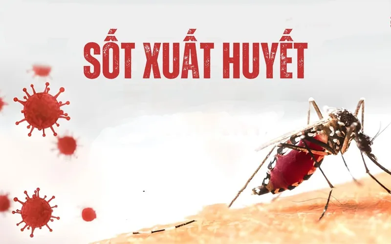 Những điều cần biết về sốt xuất huyết - Bệnh viện SANTE Bình Thạnh, TP.HCM Những điều cần biết về sốt xuất huyết - Bệnh viện SANTE Bình Thạnh, TP.HCM